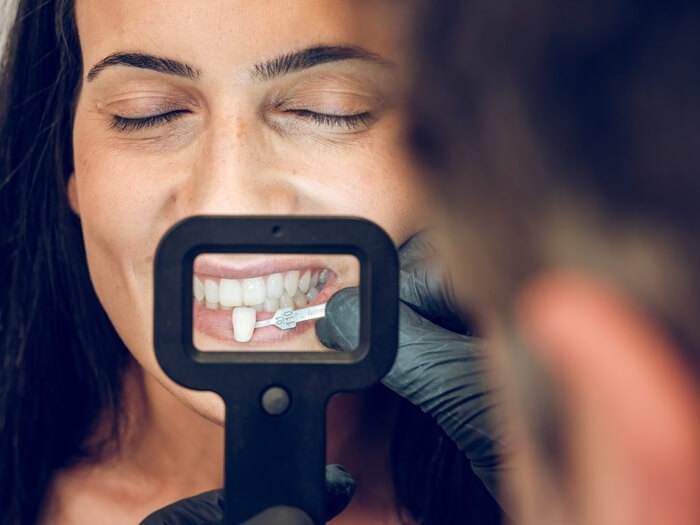 Closeup of men dentist trying on veneer for woman patient using dental mirror and instrument in clinic