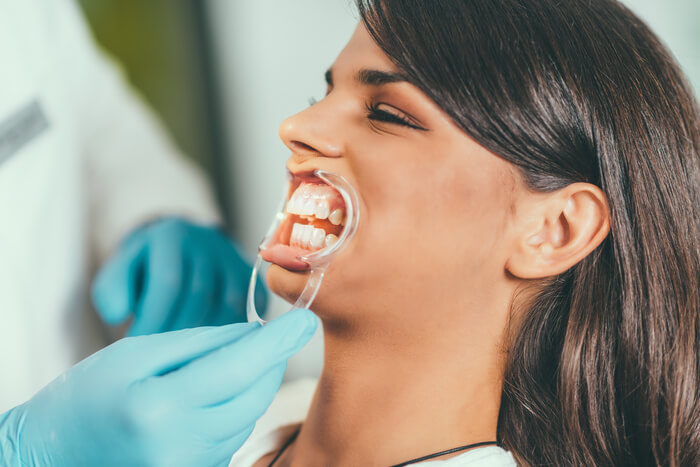 tooth-whitening-procedure-2023-11-27-05-28-33-utc